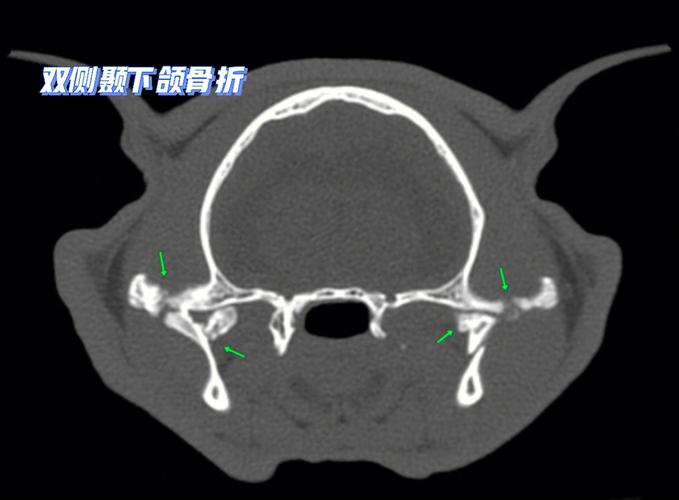 猫咪嘴巴骨折，了解常见症状与紧急处理方法