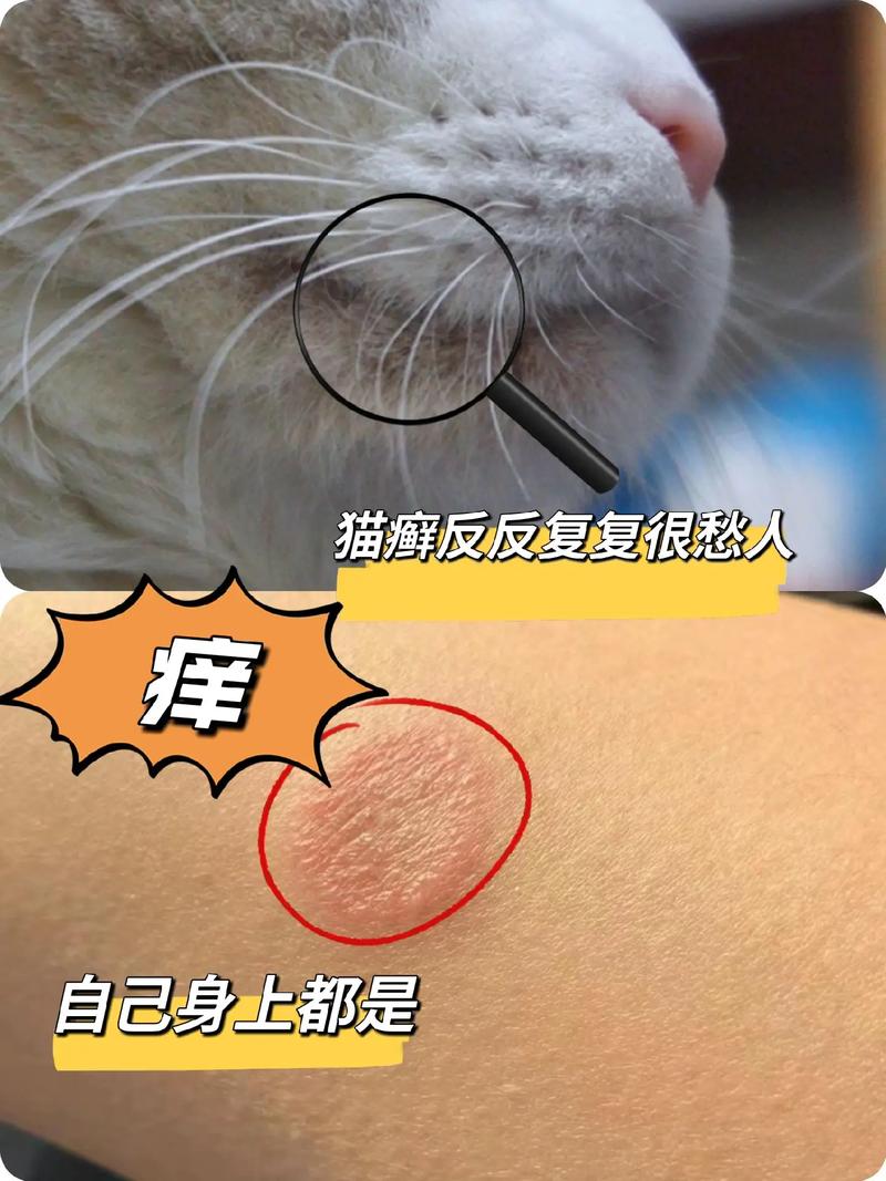 猫咪得了疥癣，如何应对猫藓这种顽疾