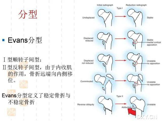 猫咪骨折治疗费用，综合考量与预算规划